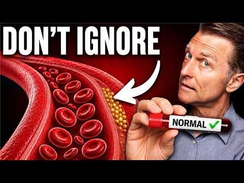 50% of Heart Attack Victims Had “Normal” Lab Results 50% of Heart Attack Victims Had “Normal” Lab Results